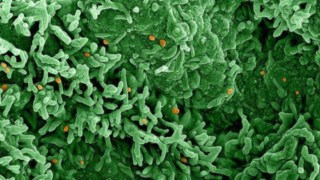 Queiroga diz que Brasil receberá antiviral para combate à varíola dos macacos Queiroga diz que Brasil receberá antiviral para combate à varíola dos macacos